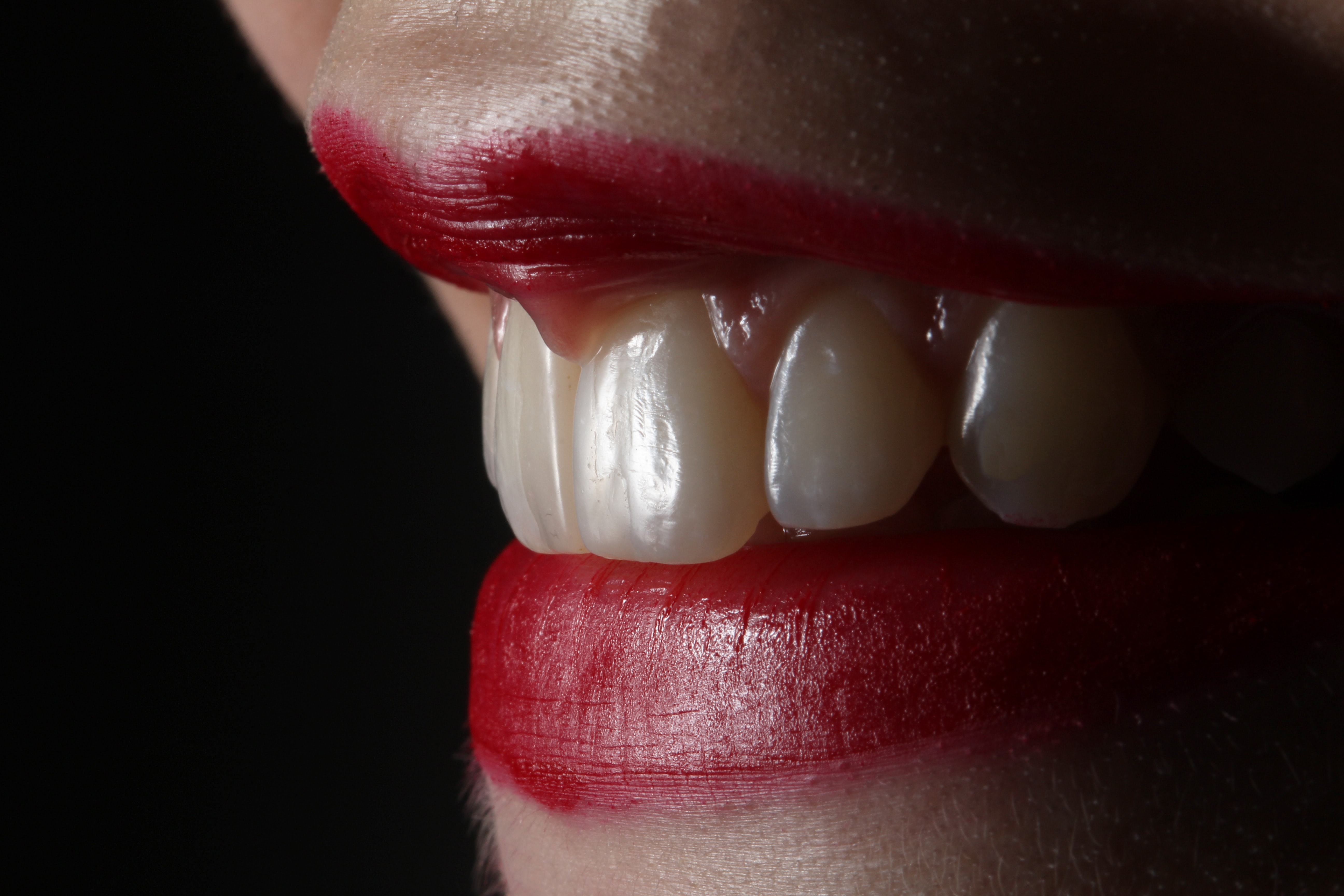 The Best Teeth Whitening Ways For You