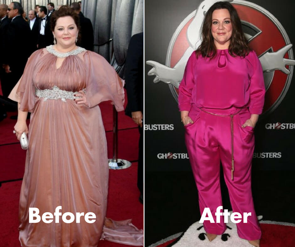 Melissa McCarthy before and after her weight loss transformation 