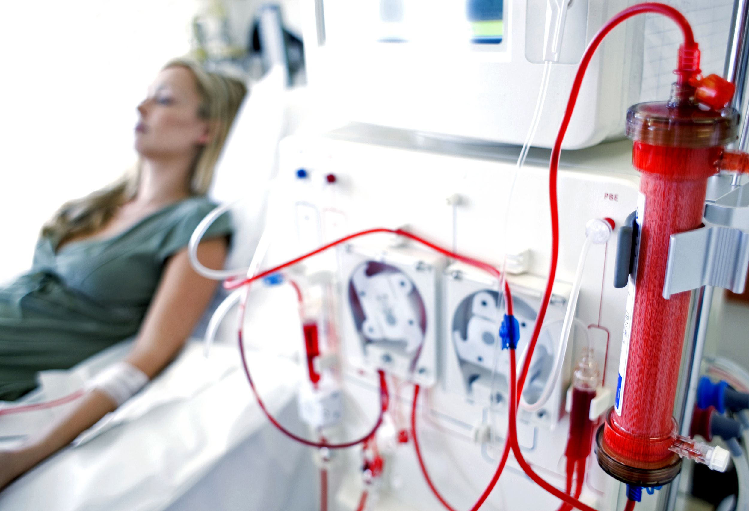 Female patient hooked up to a dialysis machine