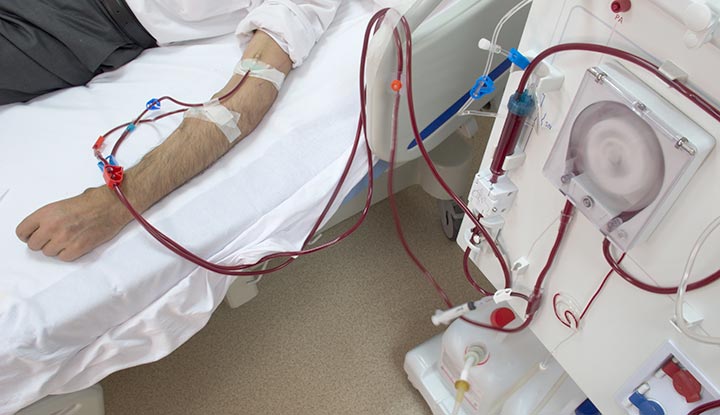 A patient hooked up to a dialysis machine