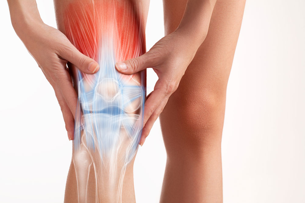A woman holding her knee with both hands with the muscles and bone around the knee highlighted in red and blue