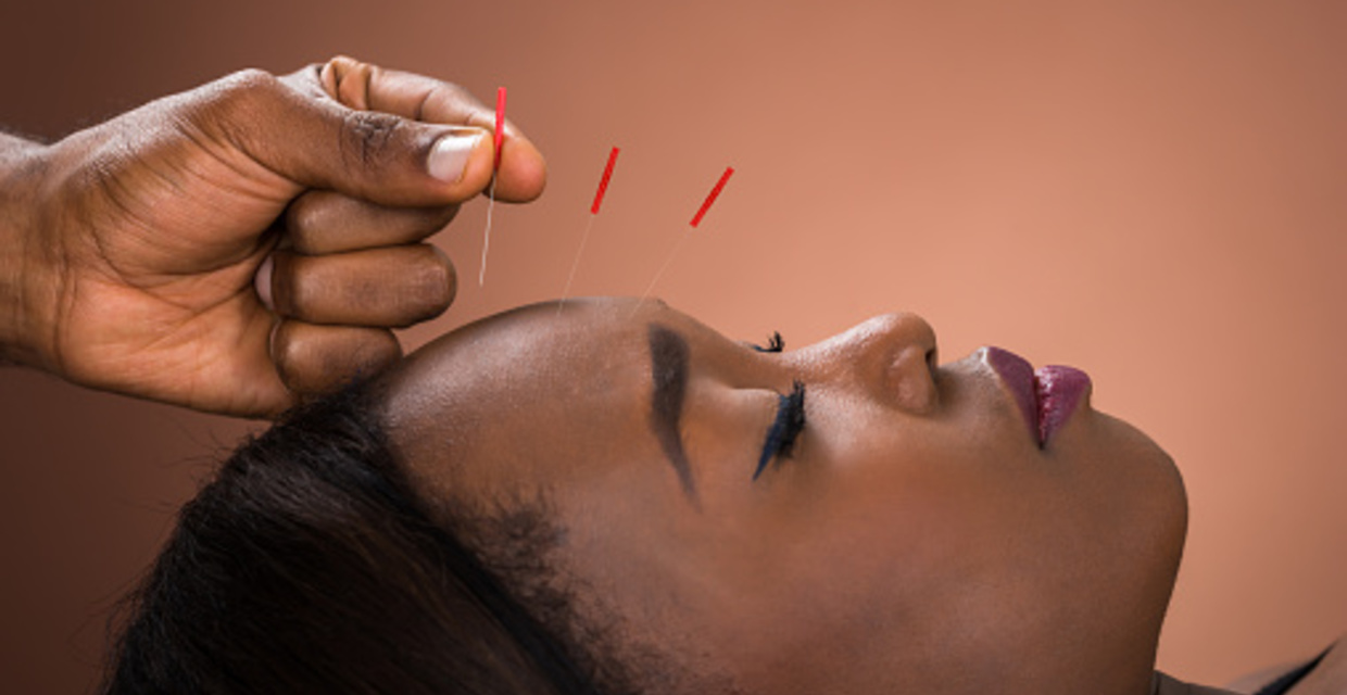 Trauma Acupuncture - How Does It Help You?
