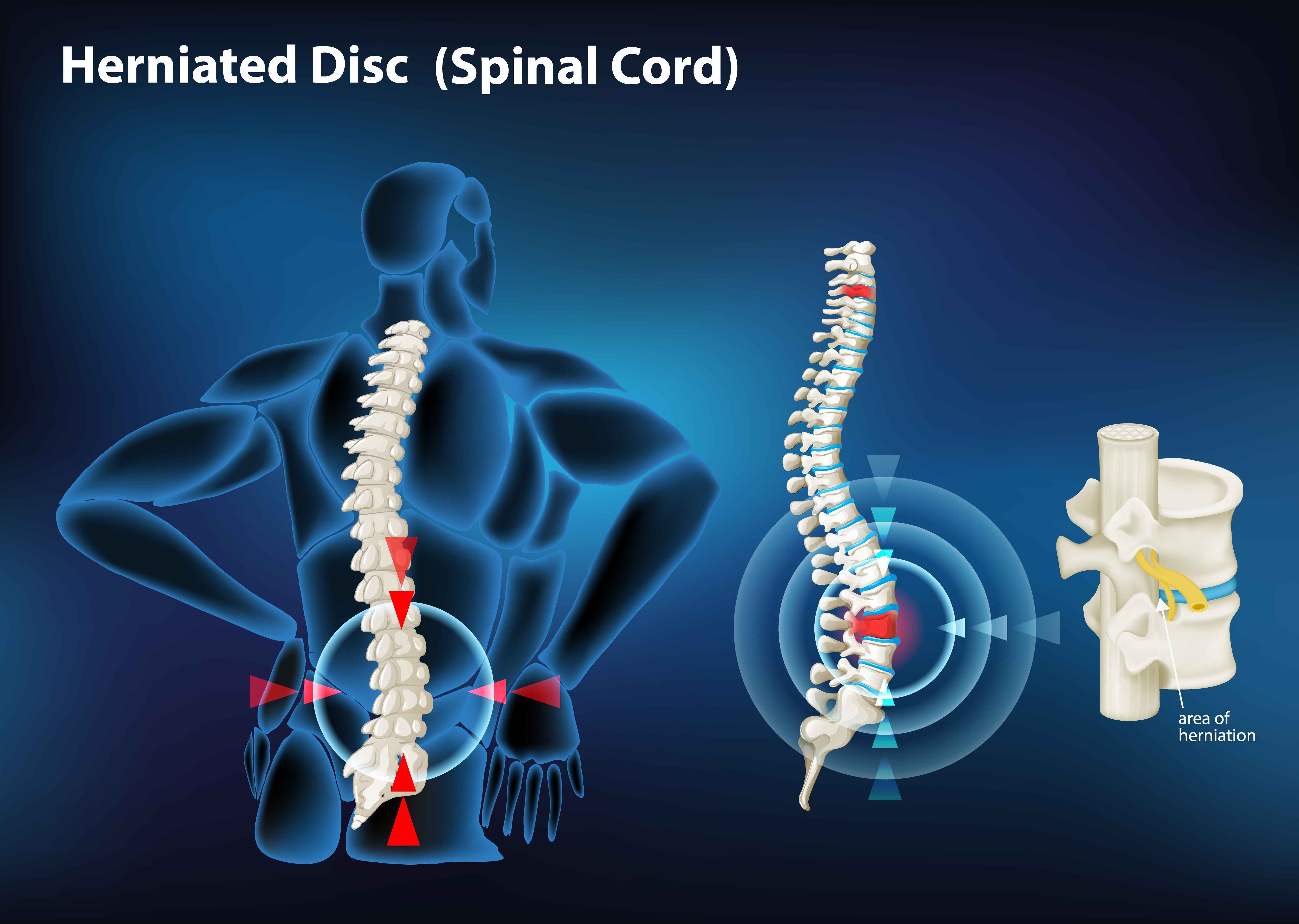 Visual description of injury in a human spinal cord