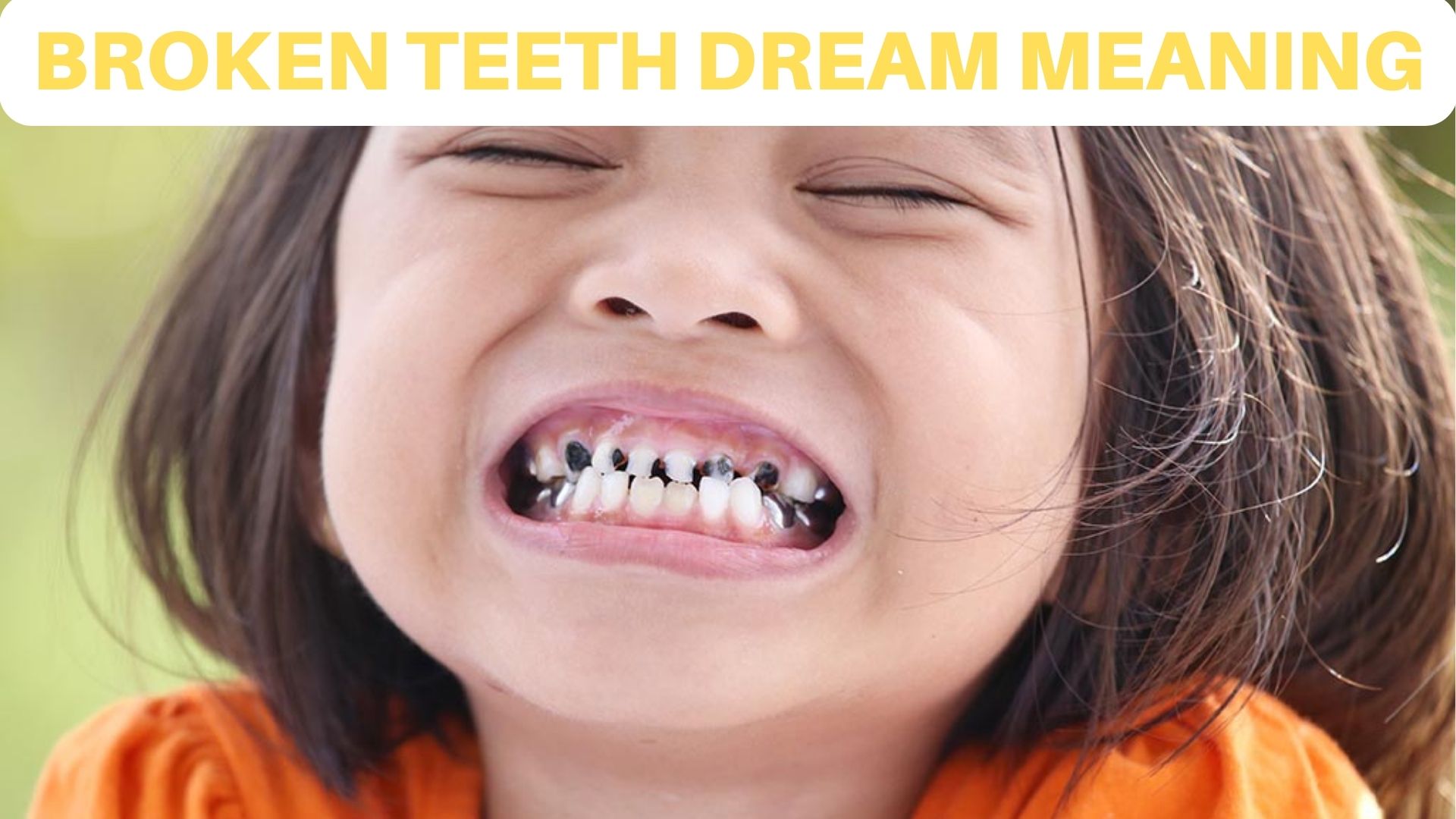 Broken Teeth Dream Meaning - Indicate Confusion Or Insecurity