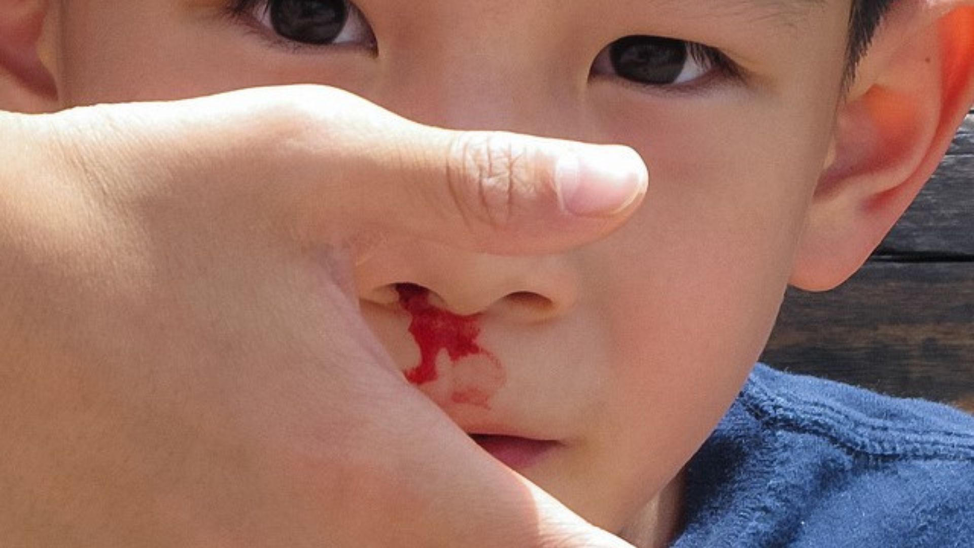 Blood From Child's Nose