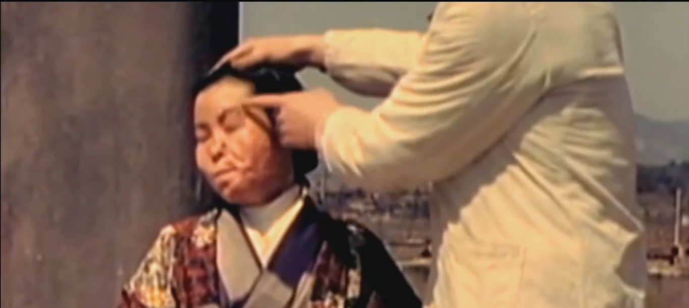 A male doctor pointing at the scarred face of a female Hiroshima survivor wearing a kimono