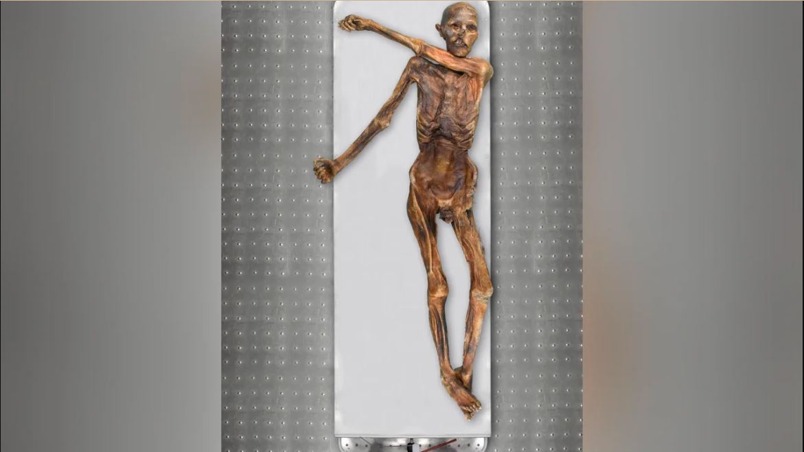 New DNA Analysis Unveils Accurate Appearance Of Ötzi The Iceman