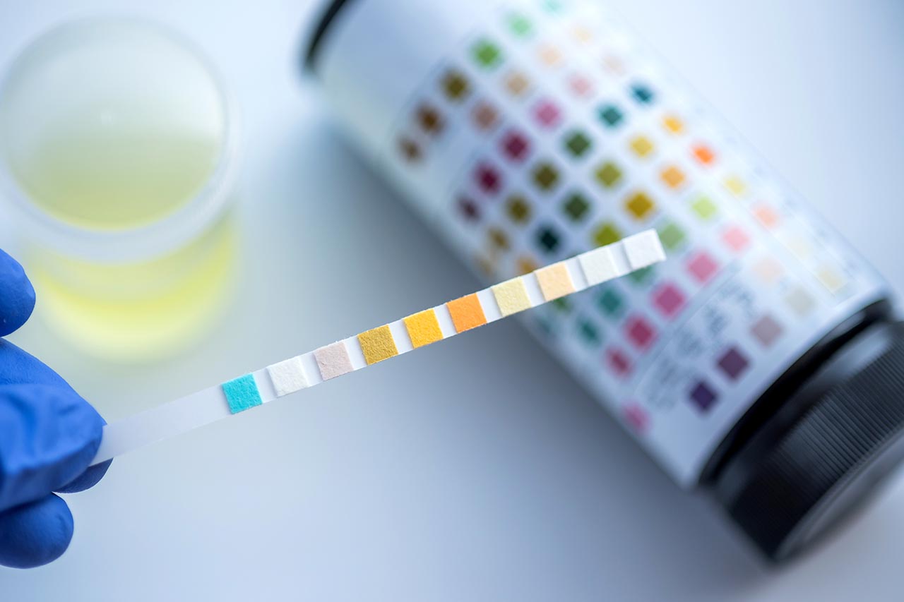 A gloved hand holds a pH test strip comparing its color changes to a reference chart on a bottle, with a sample liquid in the background.